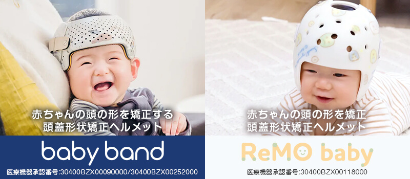 赤ちゃんの頭の形を矯正する 頭蓋形状矯正ヘルメット baby band、赤ちゃんの頭の形を矯正 頭蓋形状 矯正ヘルメット ReMO baby