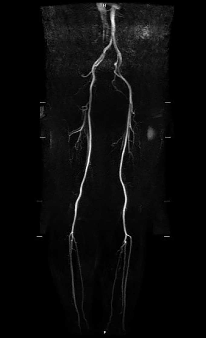 MRI参考画像 下肢