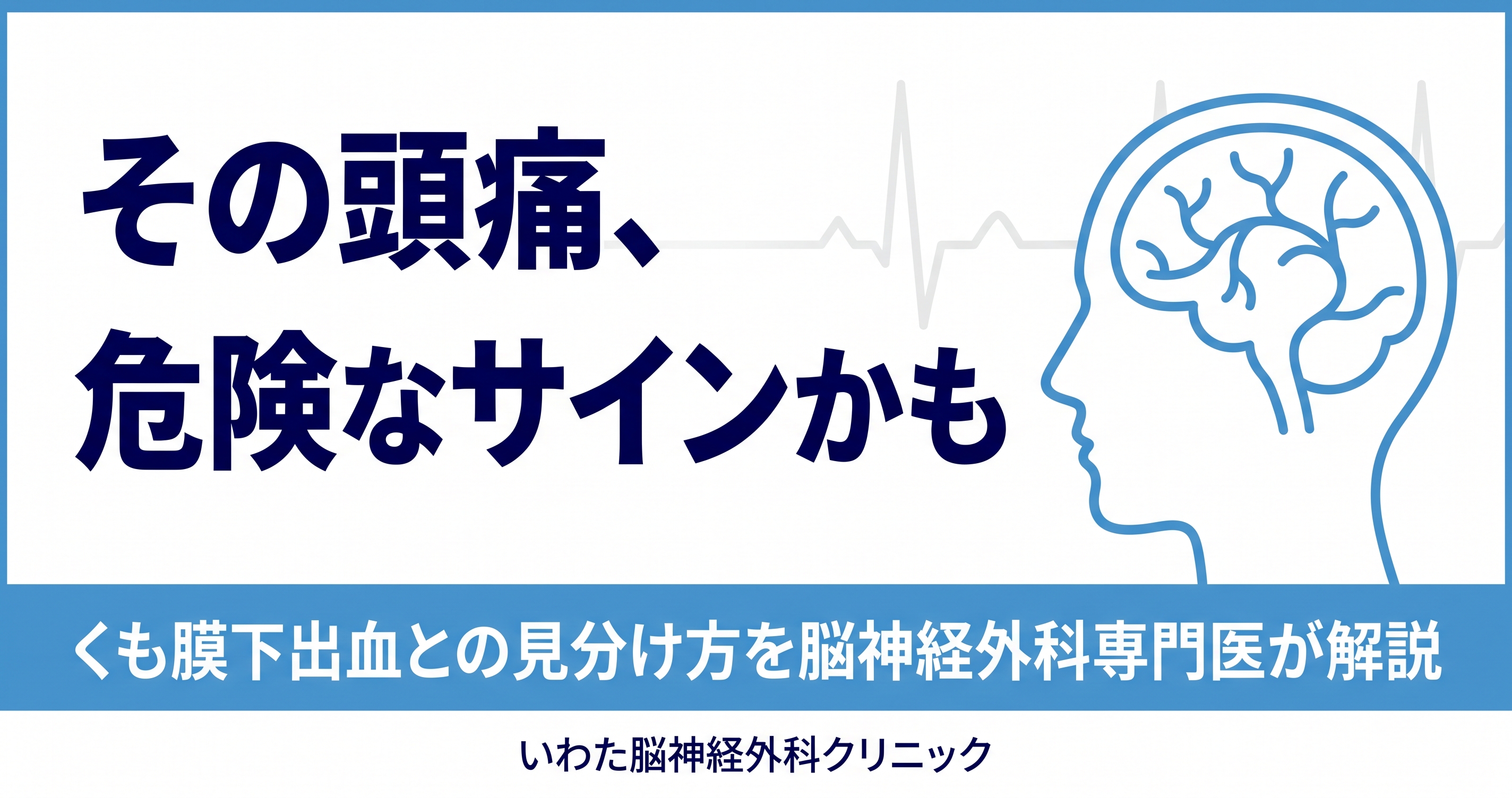 性行為に伴う頭痛とくも膜下出血など危険な頭痛の見分け方を脳神経外科専門医が解説