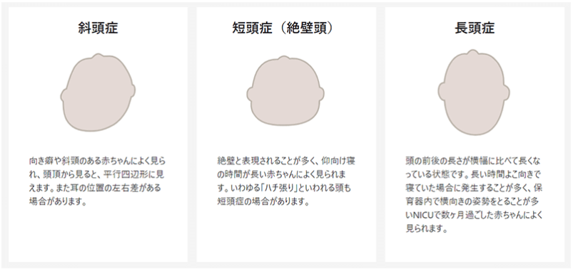 真上から見た頭のかたちのタイプ。斜頭症・短頭症・長頭症の違い